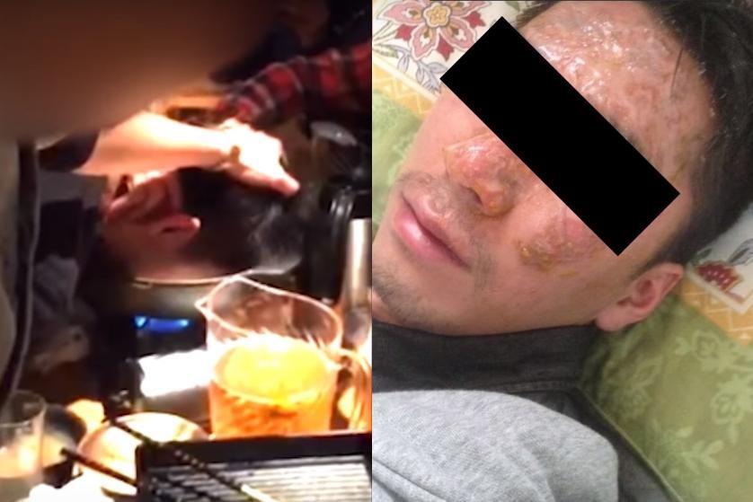 員工被社長以「取悅客戶」為由,將他的頭浸在鍋裡,造成他遭嚴重燙傷。(翻攝《週刊新潮》YouTube)