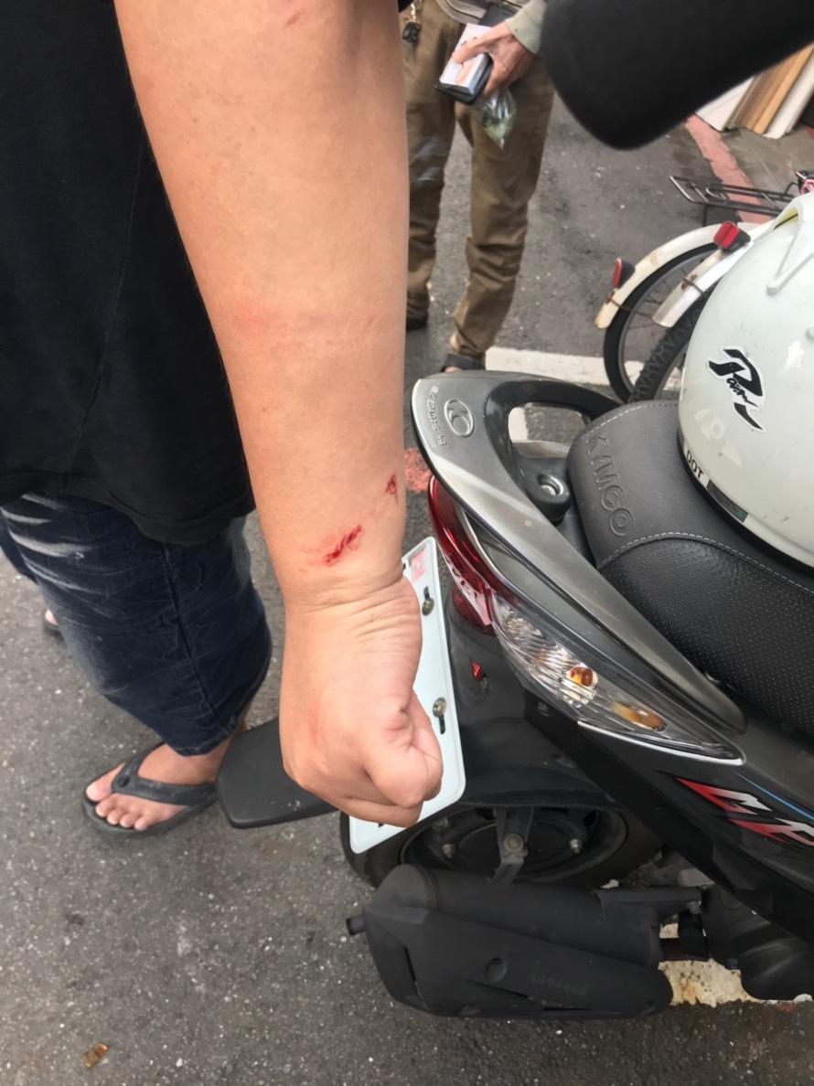 林男遭鋸子砍傷,所幸沒有大礙。(警方提供)