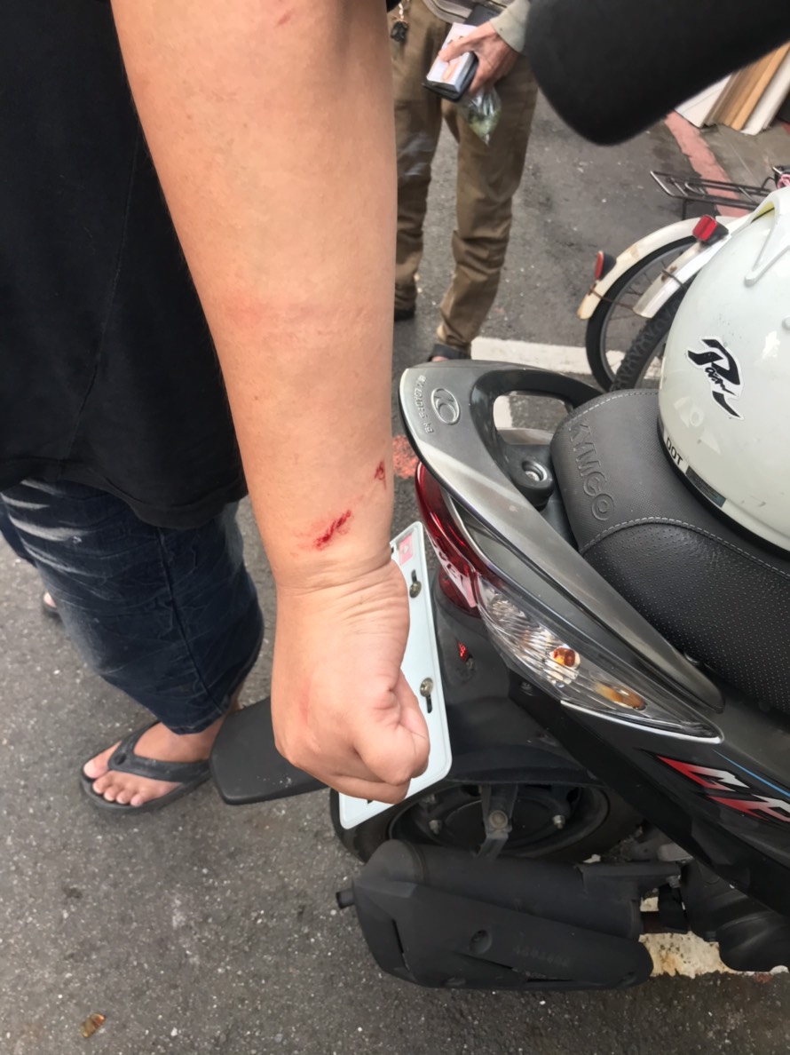 林男遭鋸子砍傷,所幸沒有大礙。(警方提供)