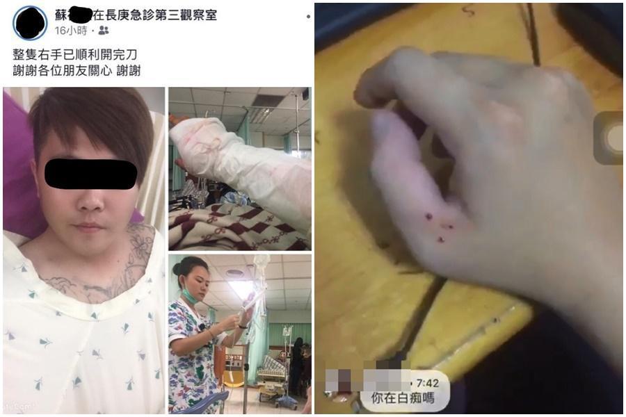 警消將蘇男送醫後，經施打血清保住手臂。（翻攝蘇男臉書）