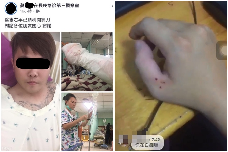 警消將蘇男送醫後，經施打血清保住手臂。（翻攝蘇男臉書）