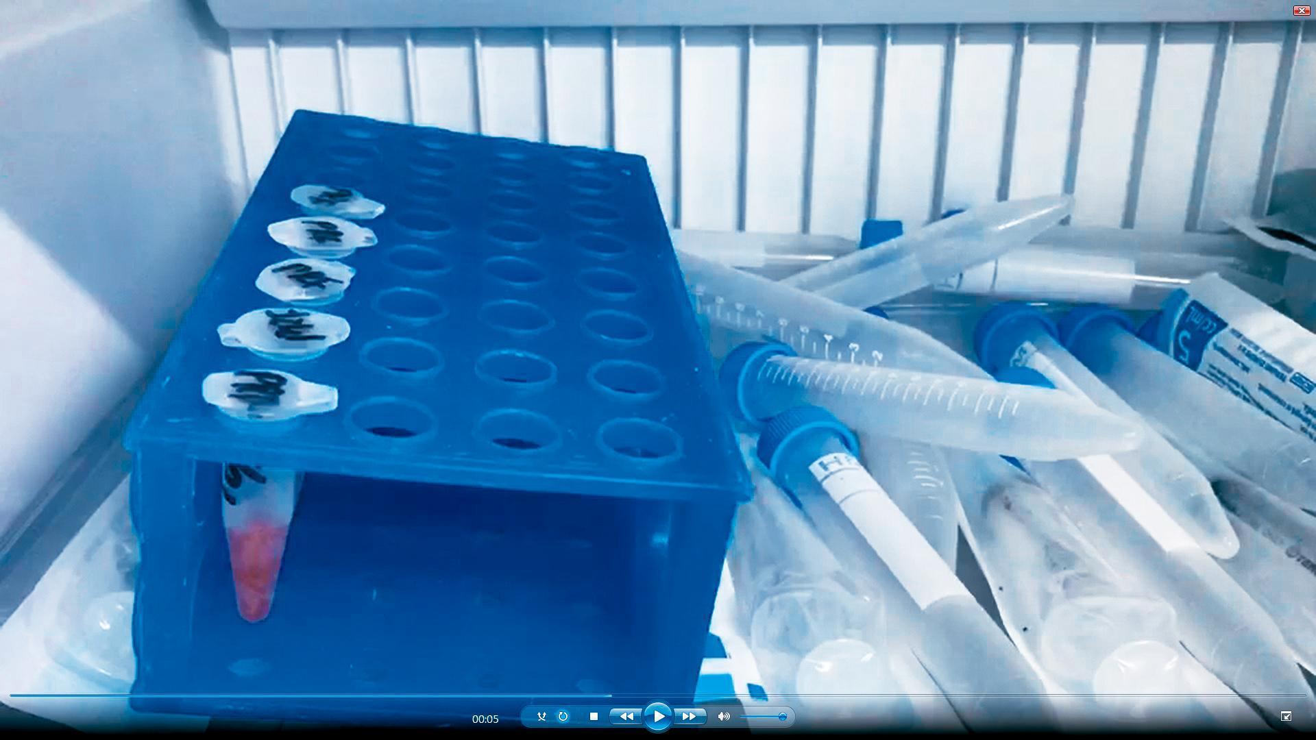 為了製作PRF血液製劑，國泰還特別打造實驗室。圖為處理過後的製劑。（讀者提供）