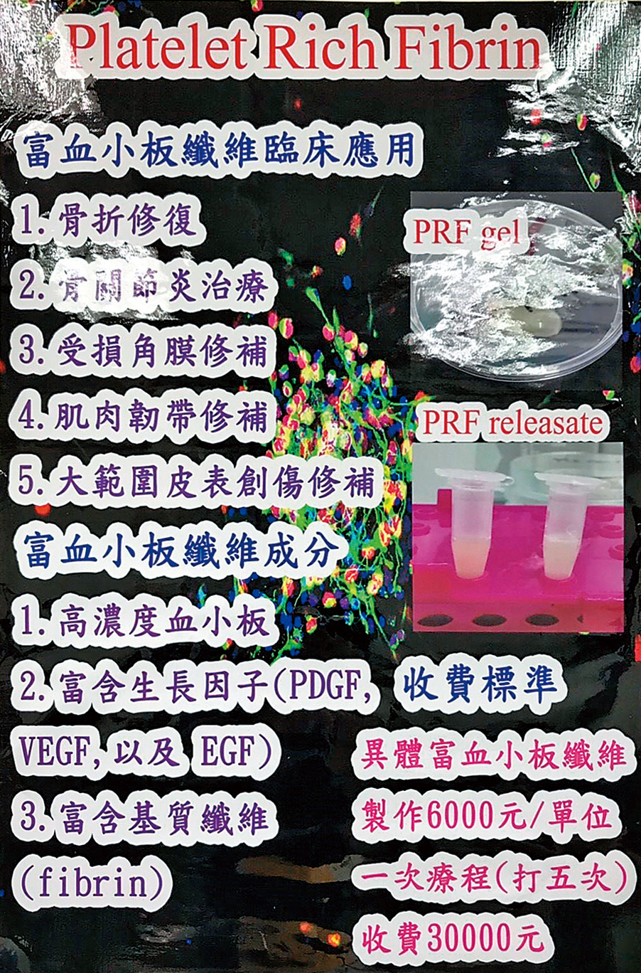 院內牆壁張貼宣稱有療效的PRF製劑,一次療程施打5劑,要價3萬元。