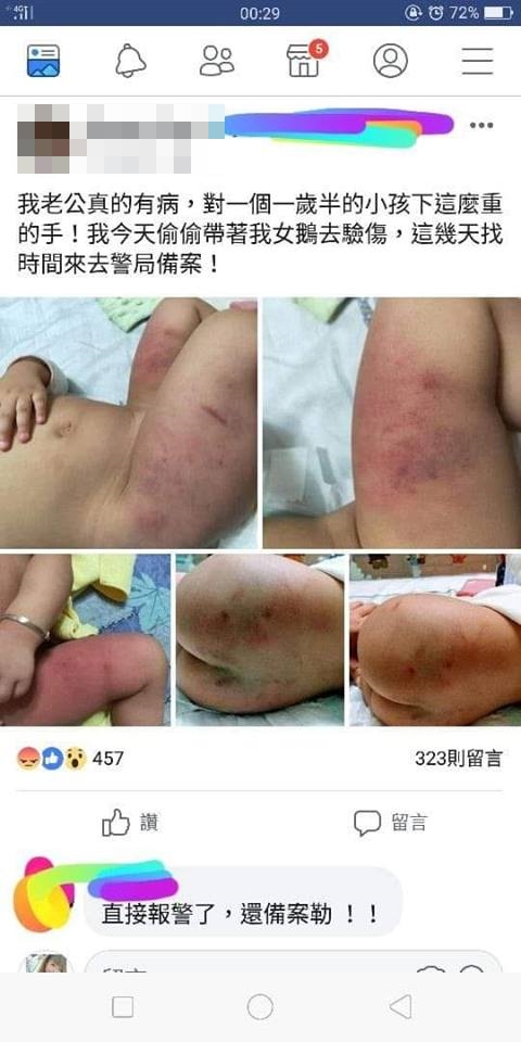 女嬰被打到滿身傷,母親居然不先報警,反而將孩子傷勢放上網路。(翻攝網路)