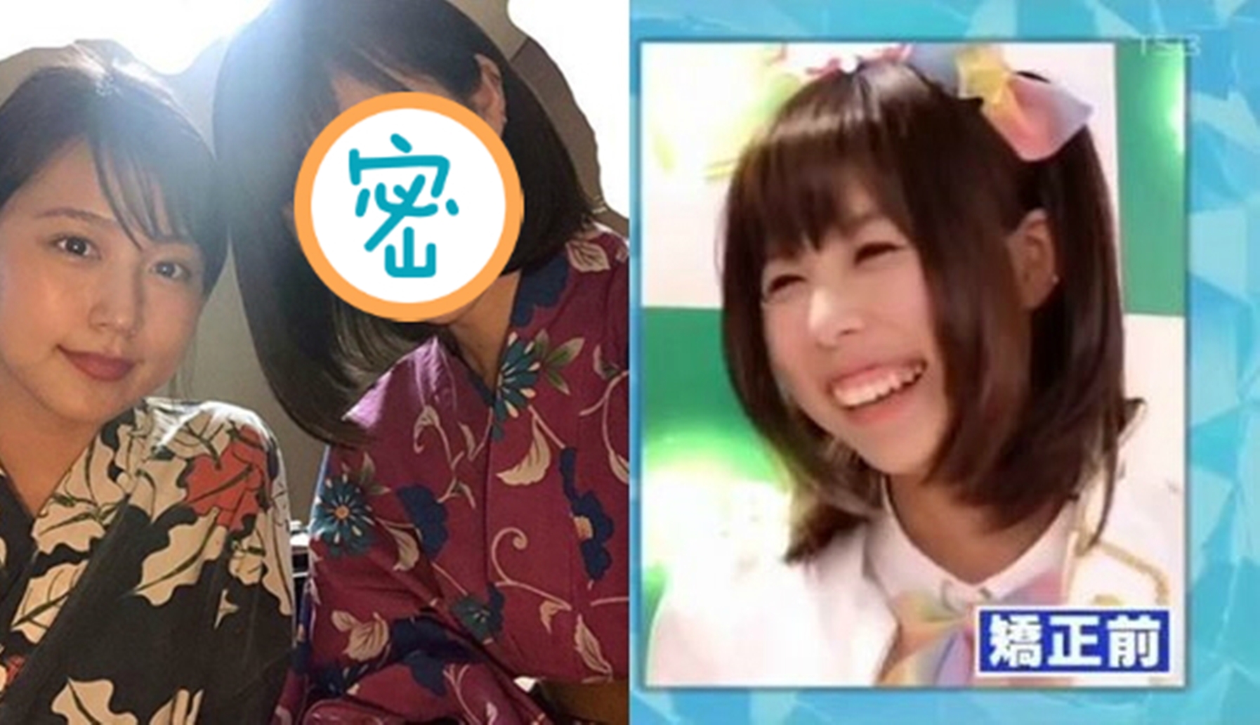 過去有村藍里笑的時候牙齦太搶戲，彷彿一隻猩猩。（合成圖片）