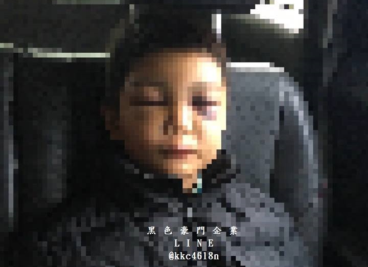 男童被繼父打得鼻青臉腫，慘況讓計程車司機也心生不忍。（翻攝畫面）