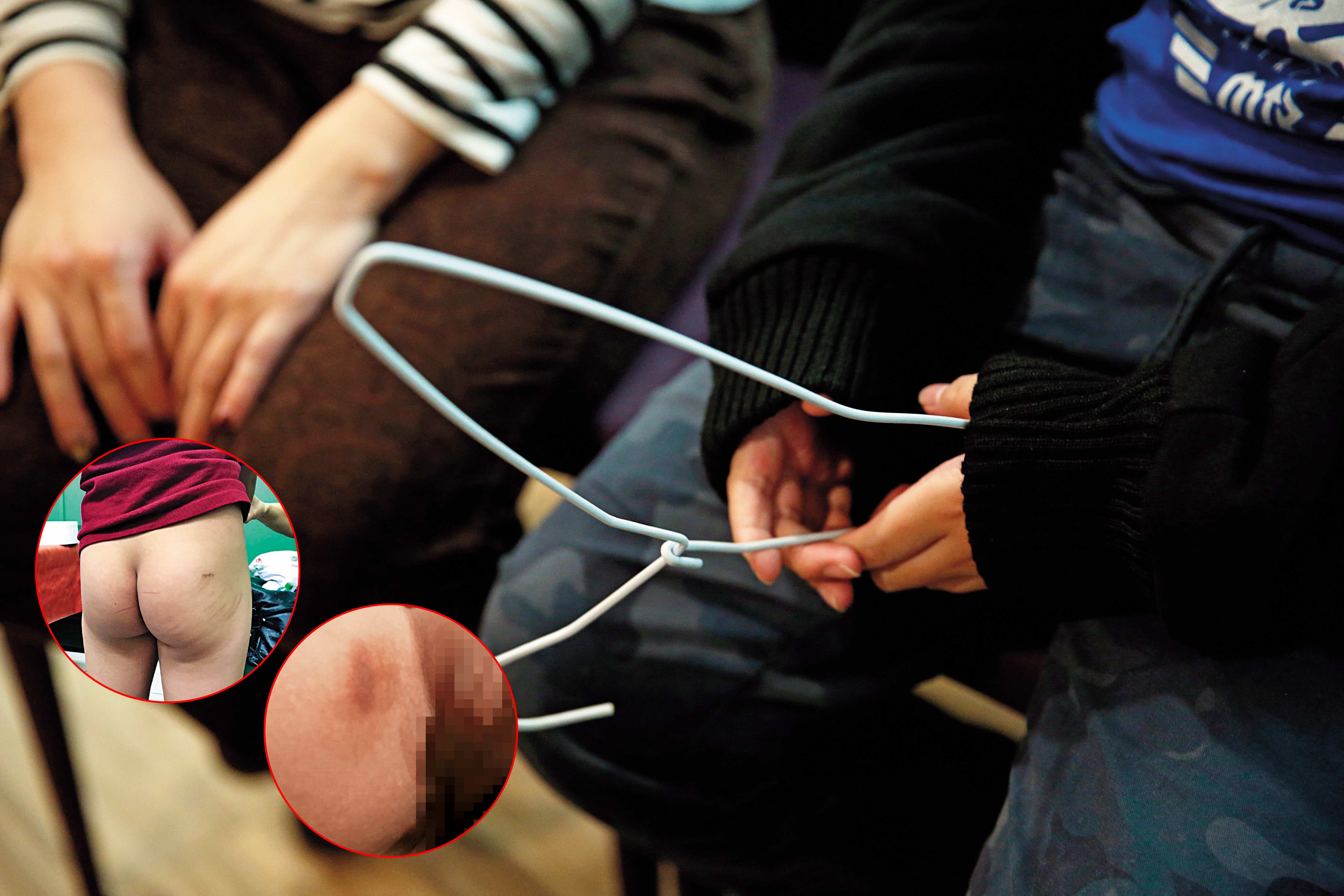 小智說，父親會拿衣架用力抽打他，還會發出咻咻的聲音。