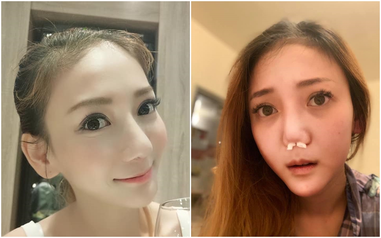 劉喬安於臉書po出近照，不過由於鼻子形狀太過詭異（右），與先前照片比對簡直判若兩人。（翻攝自劉依函臉書）