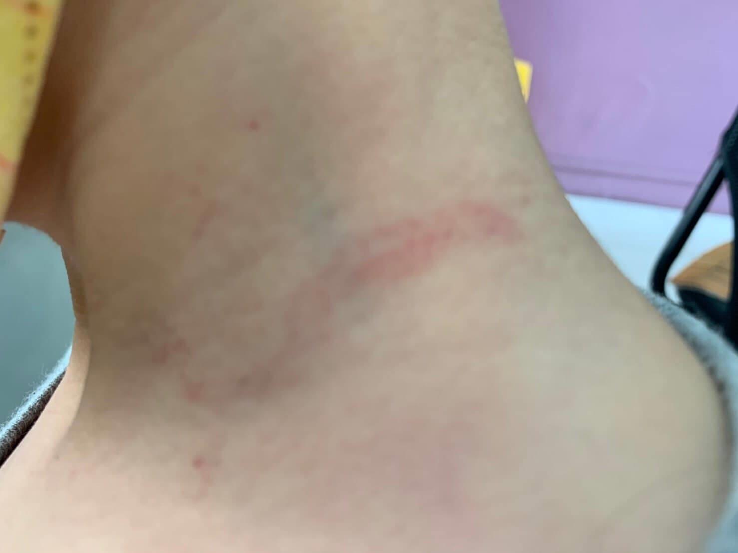 孩子頸部也有抓傷,更稱自己曾被保母丈夫打頭。(翻攝畫面)