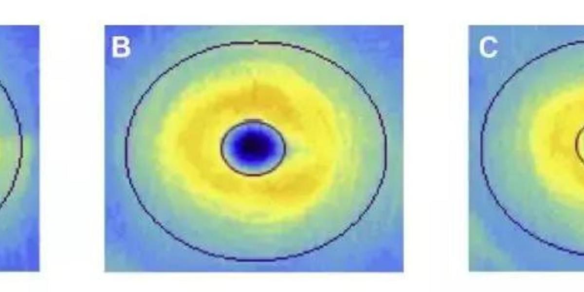 杜克大學最新研究:視網膜血管變化 透露阿茲海默症徵兆
