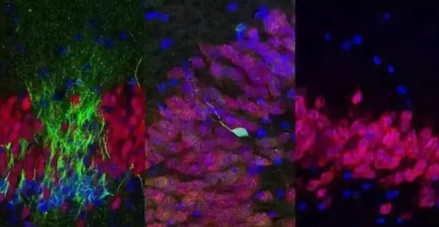 不同年齡海馬區新生細胞(綠色)的數量(左:新生,中:13 歲,右:35 歲)(來源:Arturo Alvarez-Buylla lab)