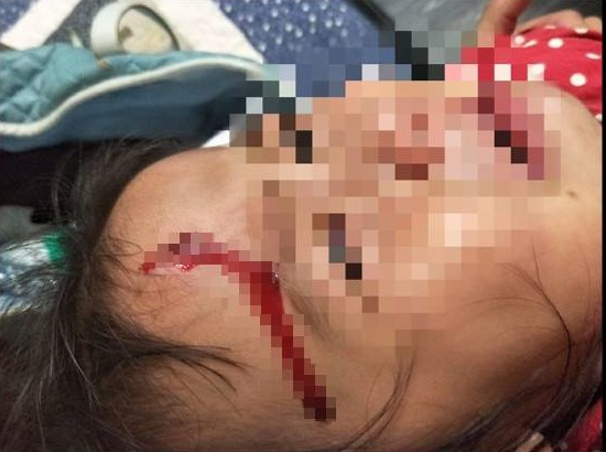 綠島一名女童因額頭受傷流血而送醫，卻意外引起一波離島醫療資源與醫病關係的討論。（圖取自「就是愛綠島」臉書））