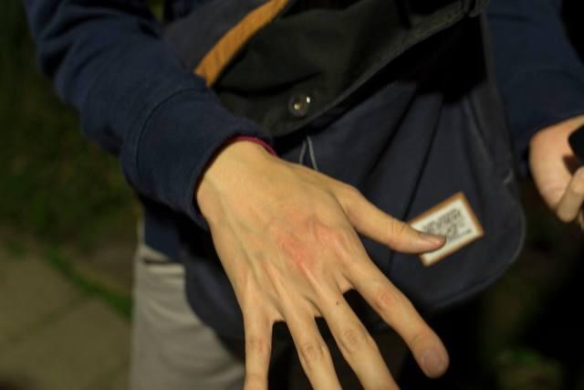 過程中被害人手上瘀血。（翻攝臉書）