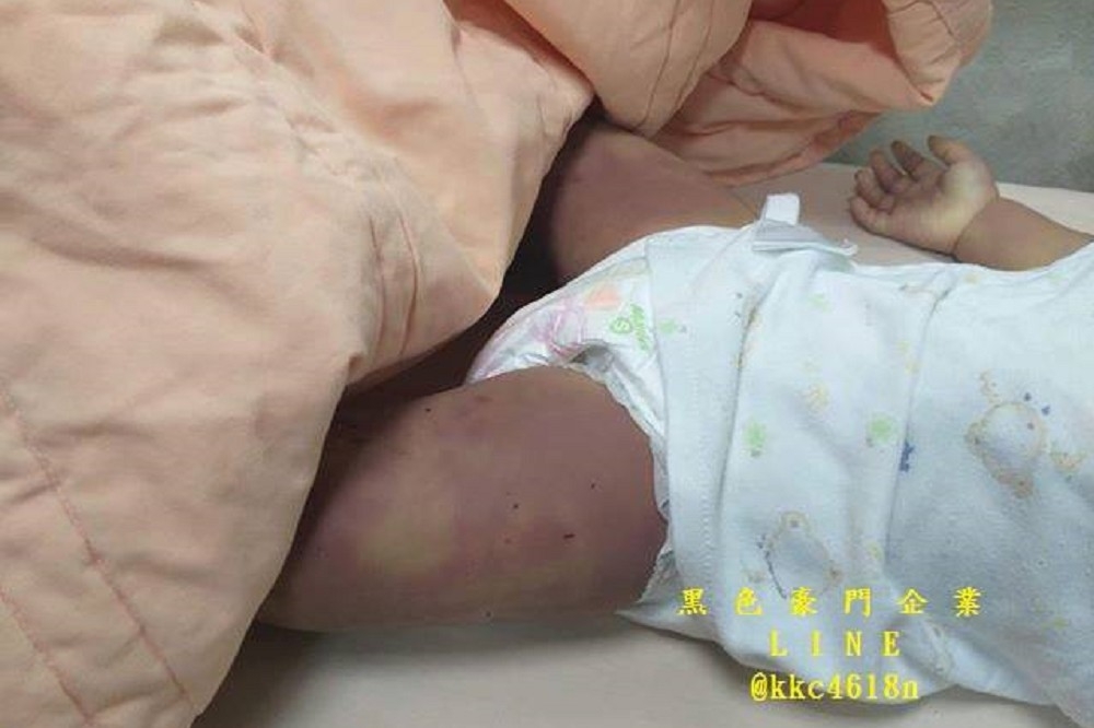 日前台南虐童案，一歲半女童遭生母及其他3人凌虐致死。（翻攝黑色豪門企業臉書）
