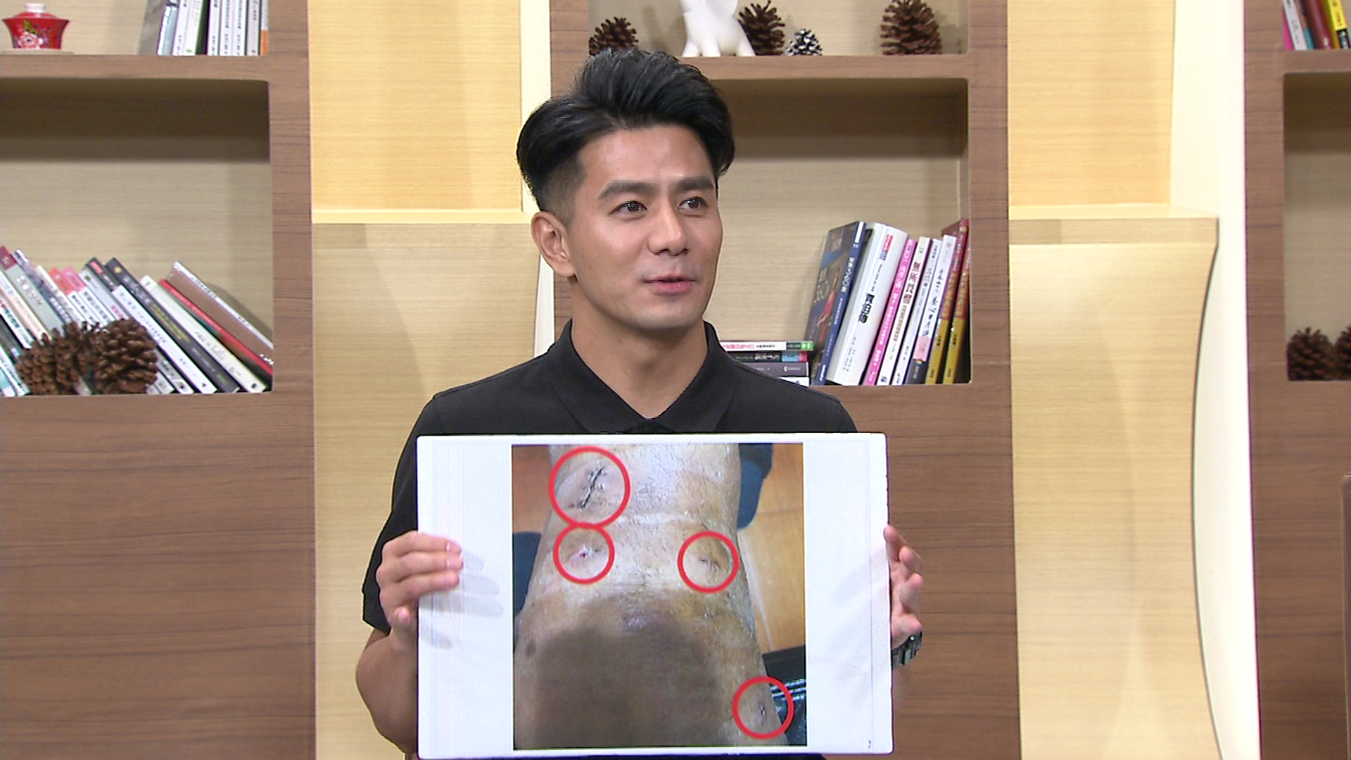 台北市立體育學院畢業的郭彥均曾是全國跳遠冠軍,卻因而留下「椎間盤突出」的病灶苦不堪言。(年代提供)