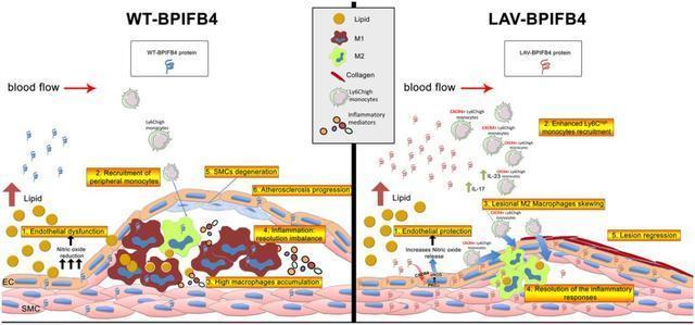 LAV-BPIFB4對於防止動脈粥樣硬化過程的發作和進展發揮保護作用，在疾病早期階段驅動動脈粥樣硬化消退並有利於消除炎症反應（來源：European Heart Journal）