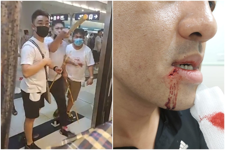 香港西鐵線元朗站21日晚間發生一群白衣人，帶著棍棒、藤條見人就打，民主黨議員林卓廷（右圖）因此受傷。（左圖翻攝自林卓廷臉書、右圖翻攝自民主黨臉書）