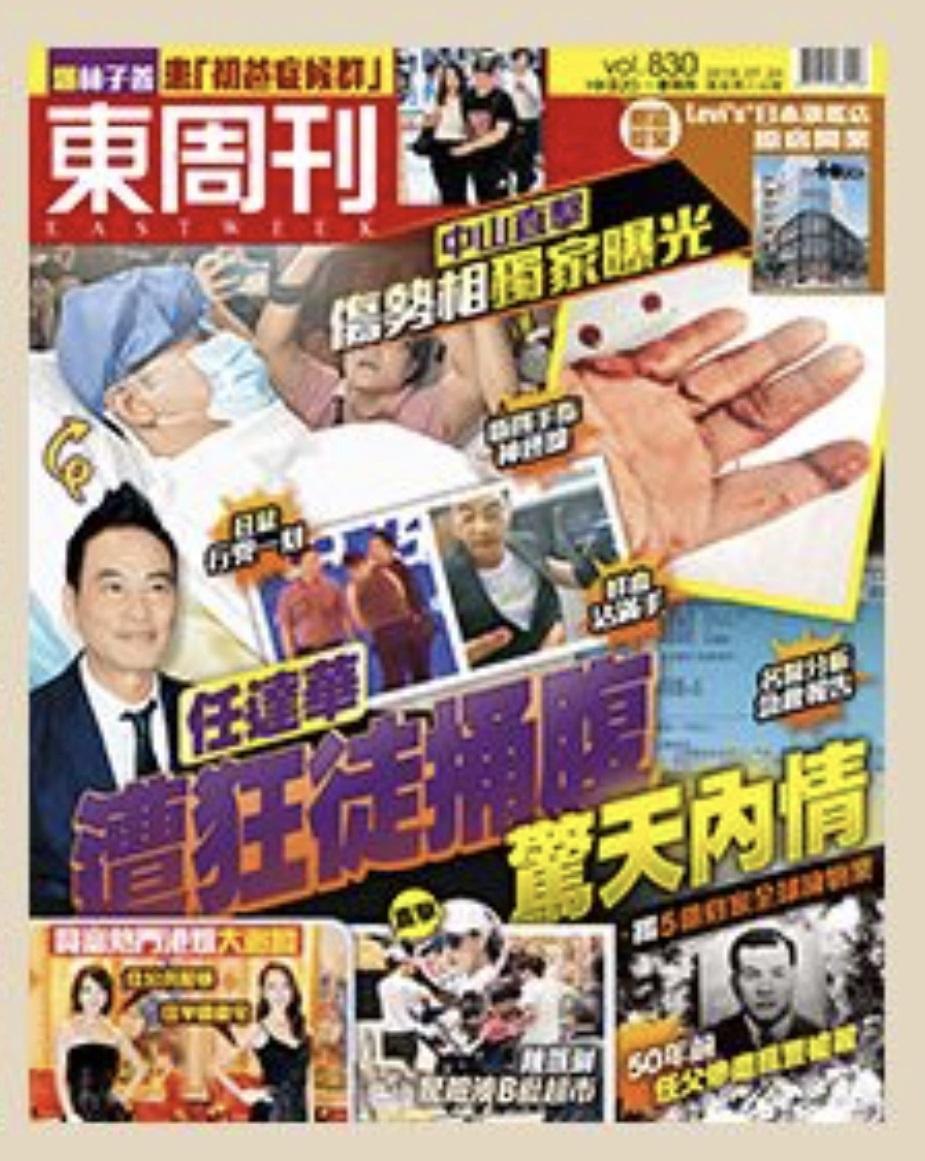 港媒曝光任達華右手傷勢照片,4指神經線遭割斷,血跡斑斑十分嚇人。(翻攝自東周刊封面)