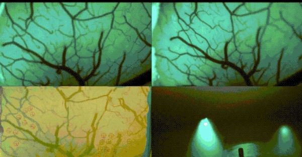 Neuralink展示探針設備成功插入過程（來源：Neuralink）