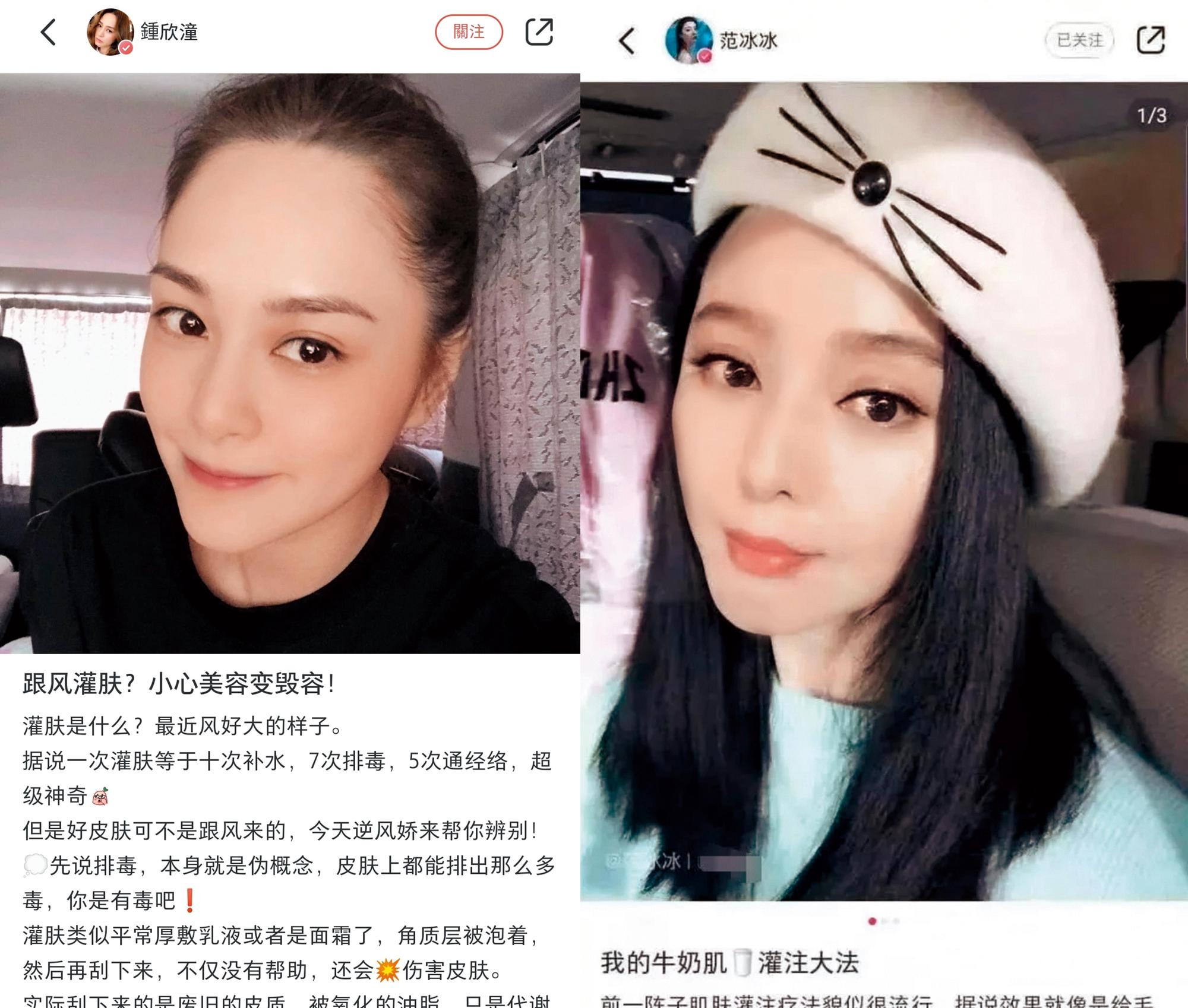 范冰冰（右圖）介紹牛奶肌灌注大法，鍾欣潼（左圖）卻指灌膚恐毀容。（翻攝自范冰冰、鍾欣潼小紅書）