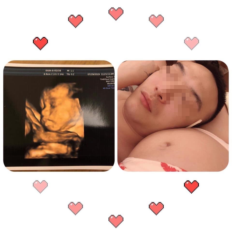 洪姓議員的老婆懷胎8個月待產中，卻在情人節收到老公與其他女人親密照。（翻攝自爆料公社））