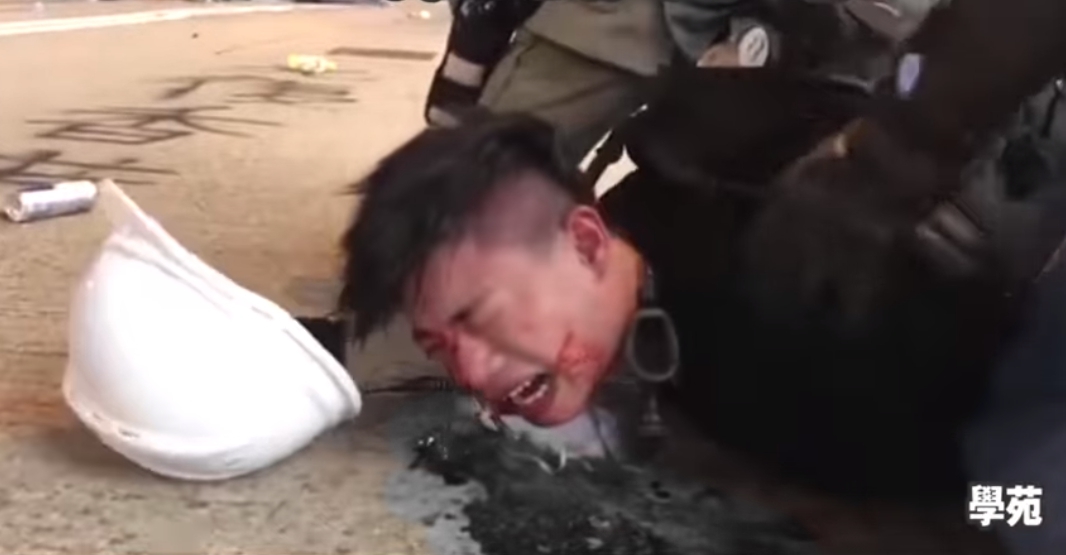 香港示威男子門牙斷裂、血流滿地，口中更不斷向警方求饒喊著「對不起」。（翻攝自臉書）