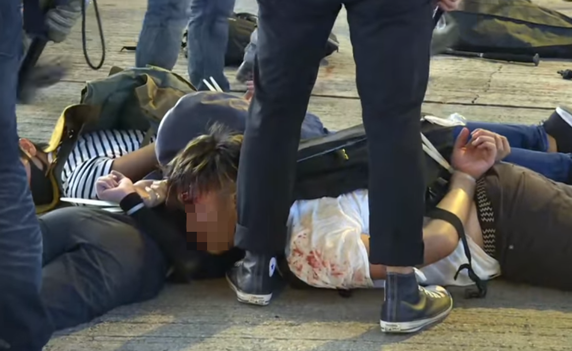示威者遭港警和黑衣人爆力壓制，導致不少人因此受傷。（翻攝臉書）