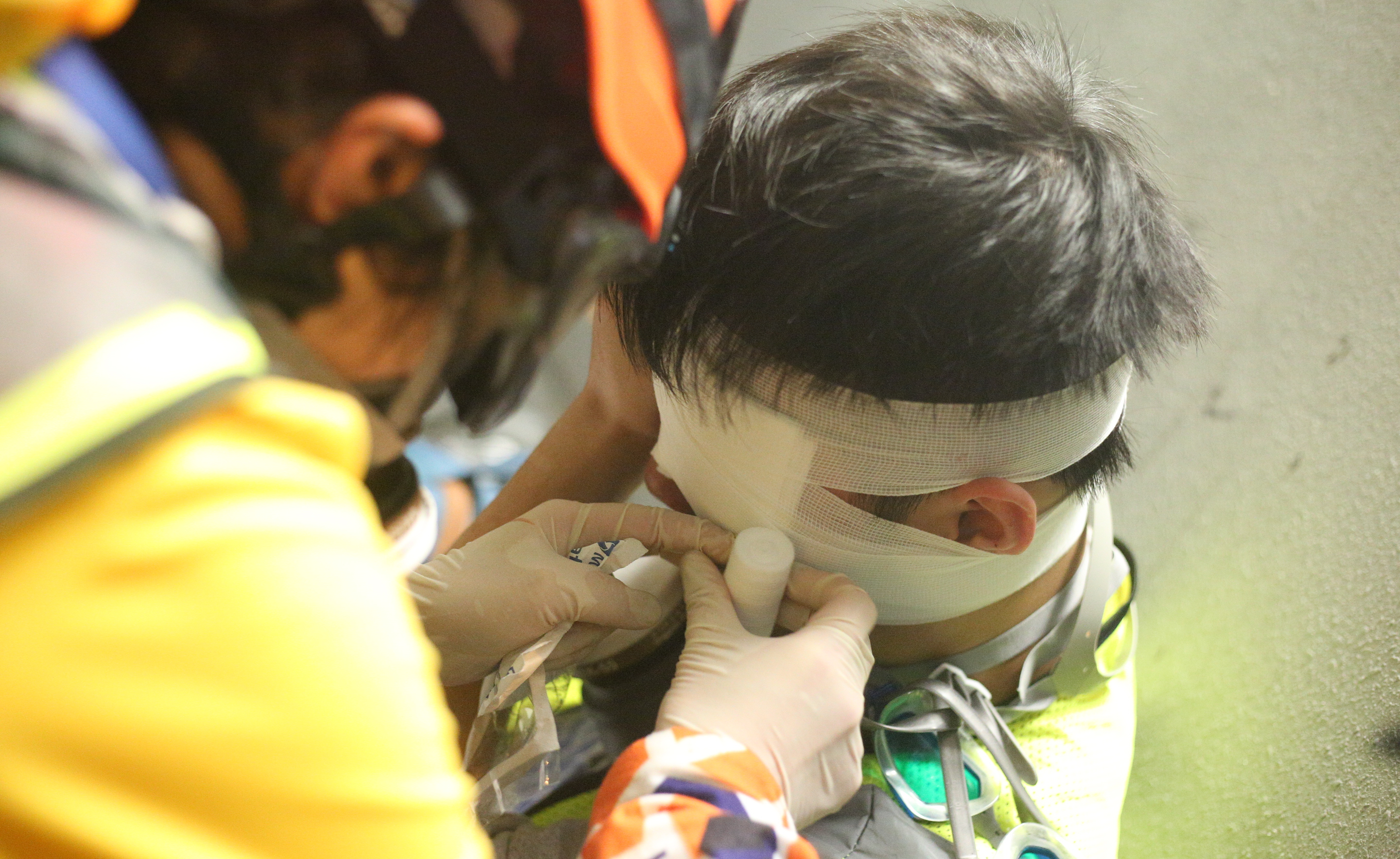 混亂中有記者被子彈射中。