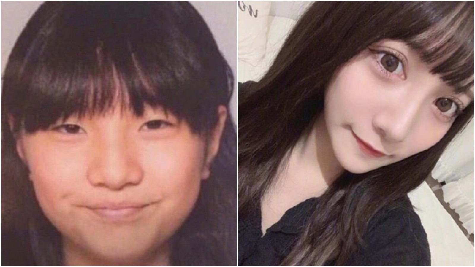 作間龍斗的私生飯不滿被偶像拒絕，整形去勾引偶像及其隊友。圖為整形前後對比。（合成圖，翻攝微博）