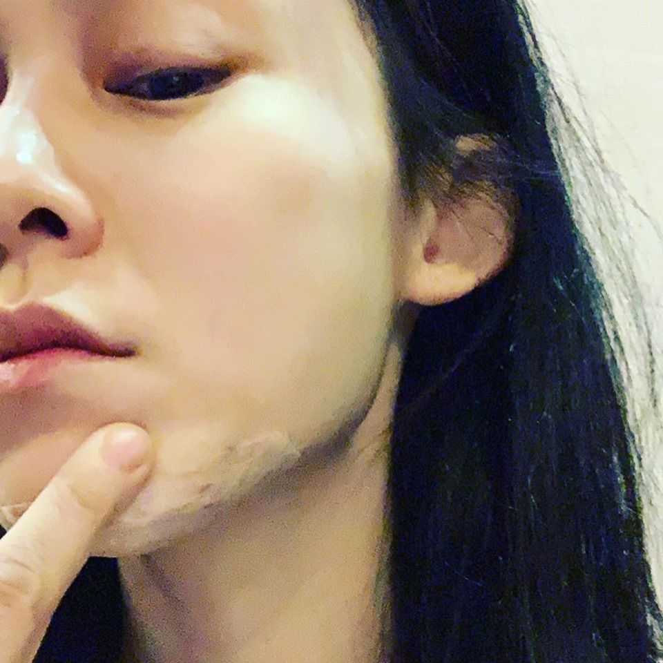 范范在社群媒體上透露自己又摔傷了，但隔天仍要出席時尚活動。（翻攝范瑋琪Instagram）