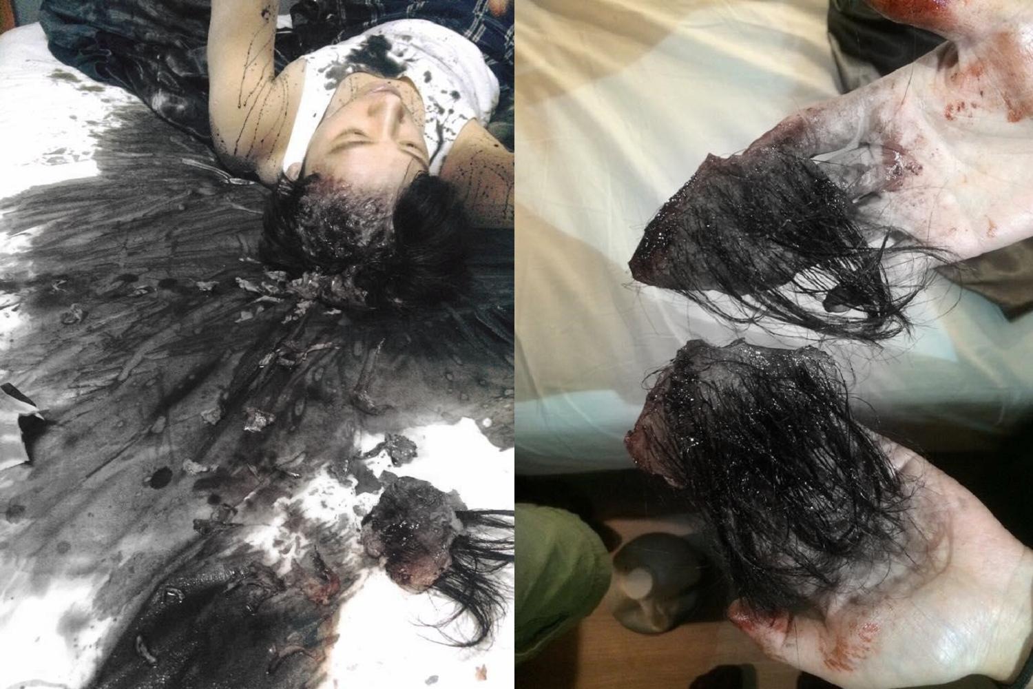 陳慕在網路劇《劣人傳之詭計》死狀淒慘、頭皮被掀開,畫面噁心驚悚。圖已經特殊處理。(翻攝自Zoe Cheng 程薇穎特效化妝臉書)