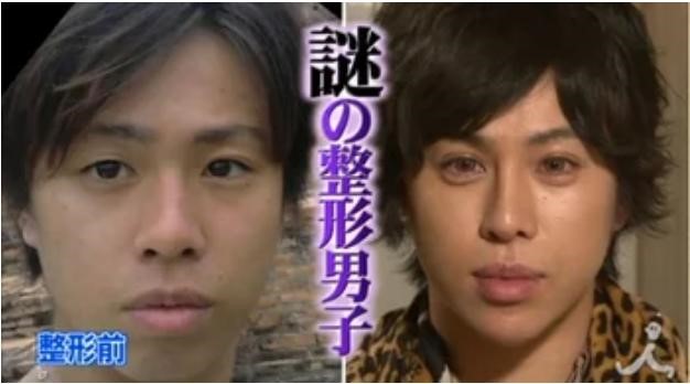 日本男星艾倫因沉迷整形，被日媒封為「謎的整形男子」。（翻攝自富士電視台）