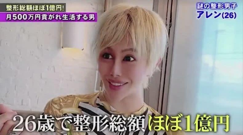 26歲的艾倫至今花在整形上的費用已高達近日幣1億元,超尖的錐子臉令人聯想到中國網紅「蛇精男」。(翻攝自富士電視台)