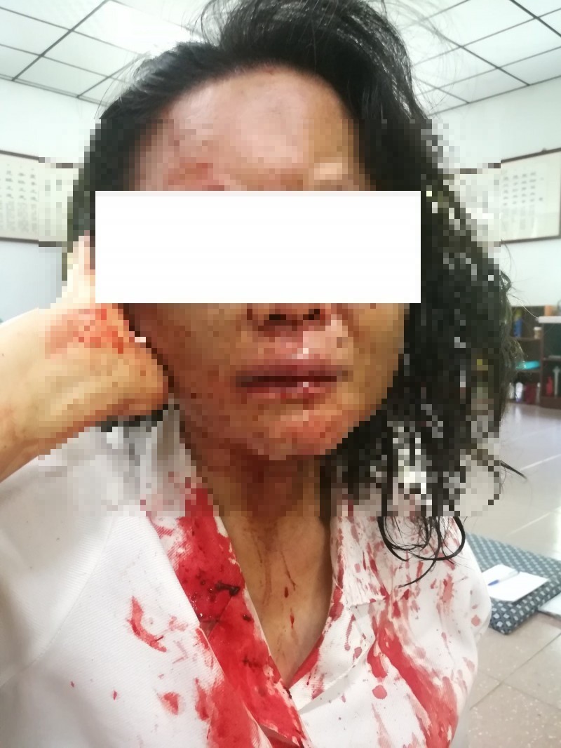 信徒讓邪教洗腦，即使被毆打得遍體鱗傷，仍認為是再驅魔。（翻攝畫面）