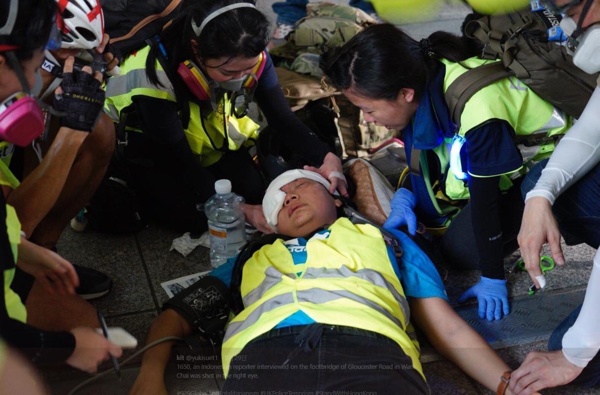香港當地的印尼語傳媒一名女記者Veby Mega Indah，採訪遊行時遭港警射中右眼。（翻攝自@yukisuet1推特）