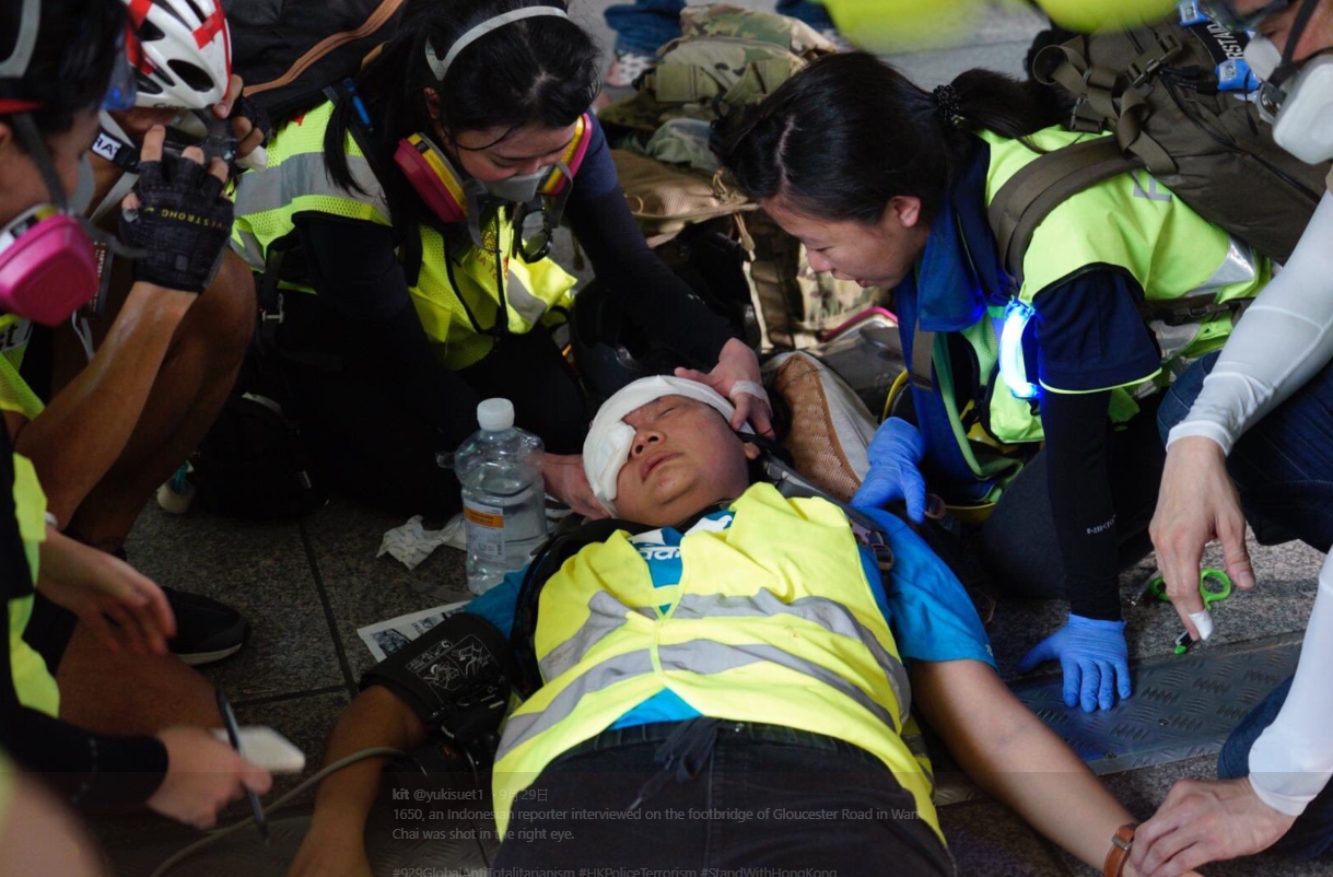 香港當地的印尼語傳媒一名女記者Veby Mega Indah，採訪遊行時遭港警射中右眼。（翻攝自@yukisuet1推特）