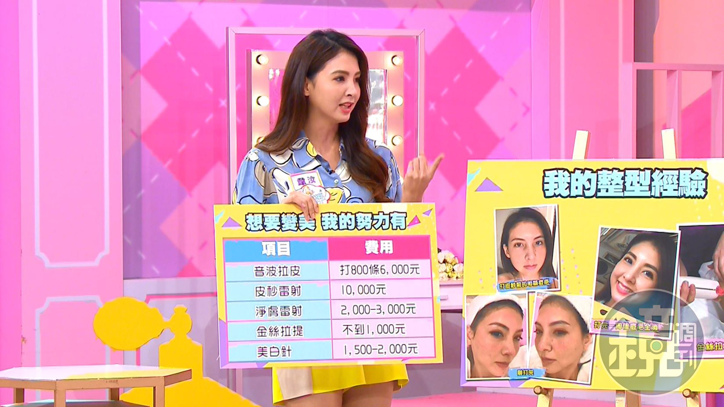 韋汝坦蕩說自己接觸醫美已經10幾年時間，大方承認，整個臉都是打出來的。（TVBS歡樂台）
