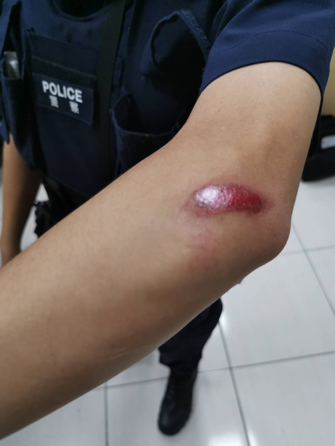 蘆洲分局德音所2員警在攔阻林嫌逃逸時，遭拖行受傷。（翻攝畫面）