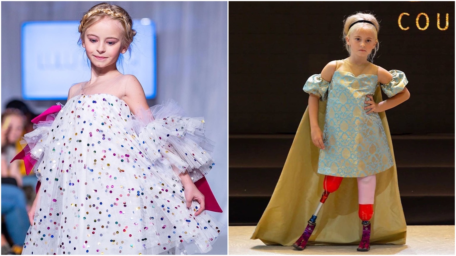 黛西德梅特因病，在出生後18個月進行雙腿截肢。（合成圖，翻攝自德梅特臉書）