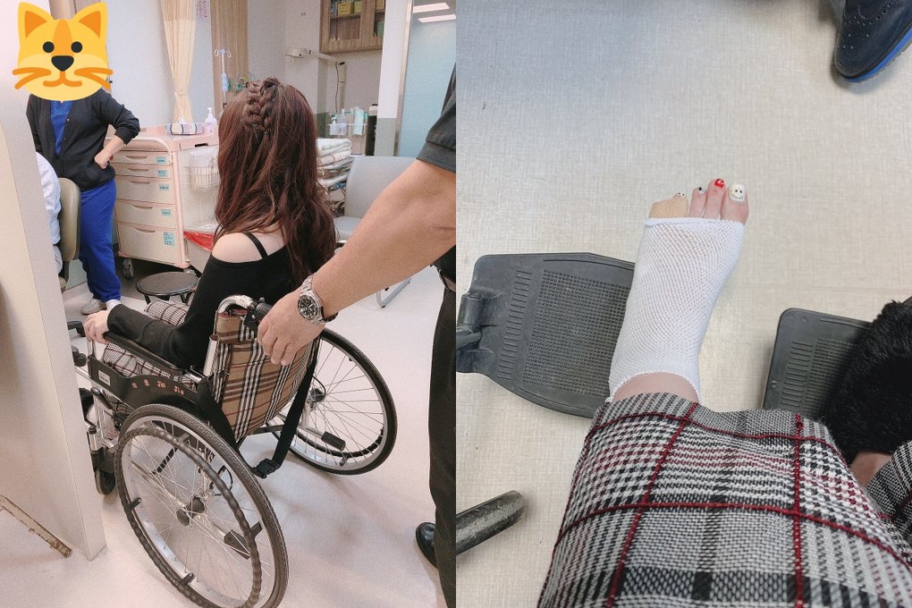 波多野結衣在推特上貼出就醫照片，醫生診斷後確定是骨折。（翻攝自波多野結衣推特）