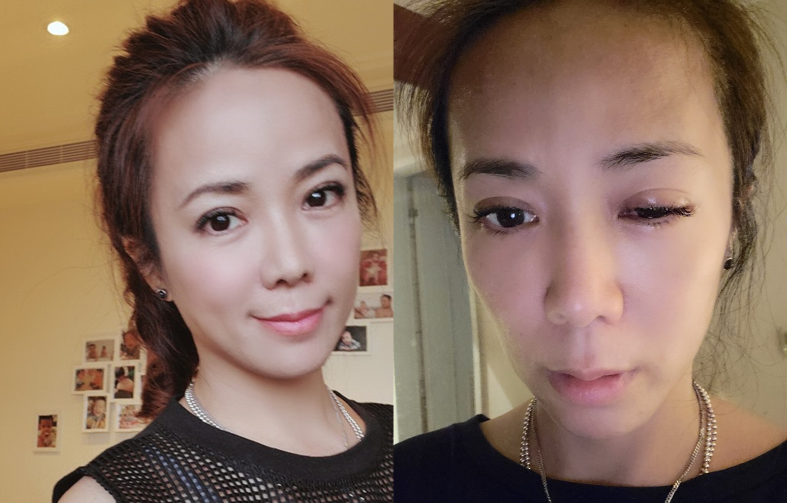 陳仙梅眼睛腫如核桃，依舊心繫兒子的萬聖節活動，讓她覺得自己不夠愛自己。（翻攝自陳仙梅臉書）