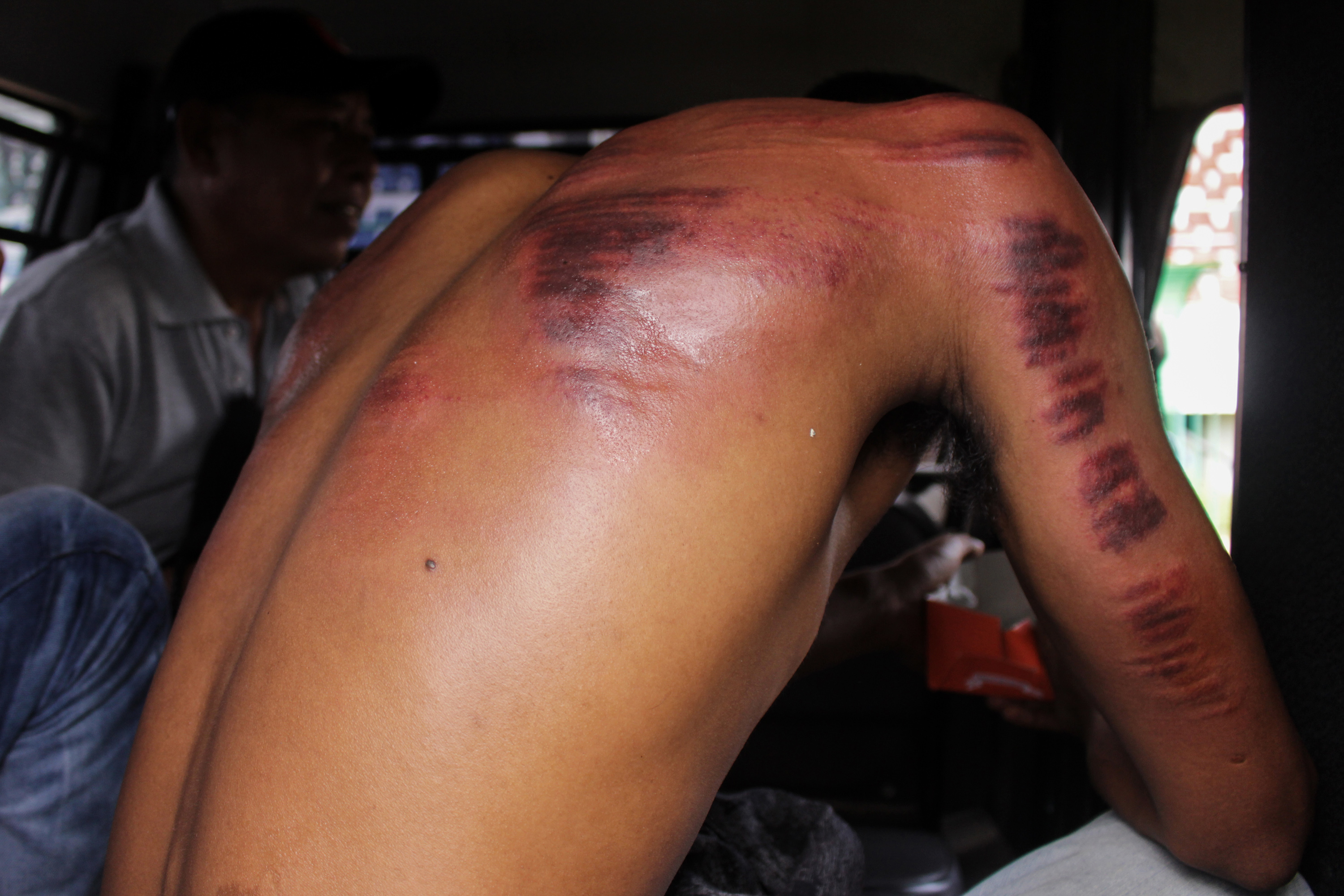 穆可利斯遭鞭打28下，一度在現場痛到慘叫，相當諷刺。（示意圖，東方IC）