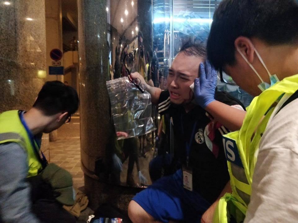 香港民主黨議員趙家賢欲制止凶嫌時,左耳遭咬傷,部分掉落。(翻攝自林卓廷臉書)