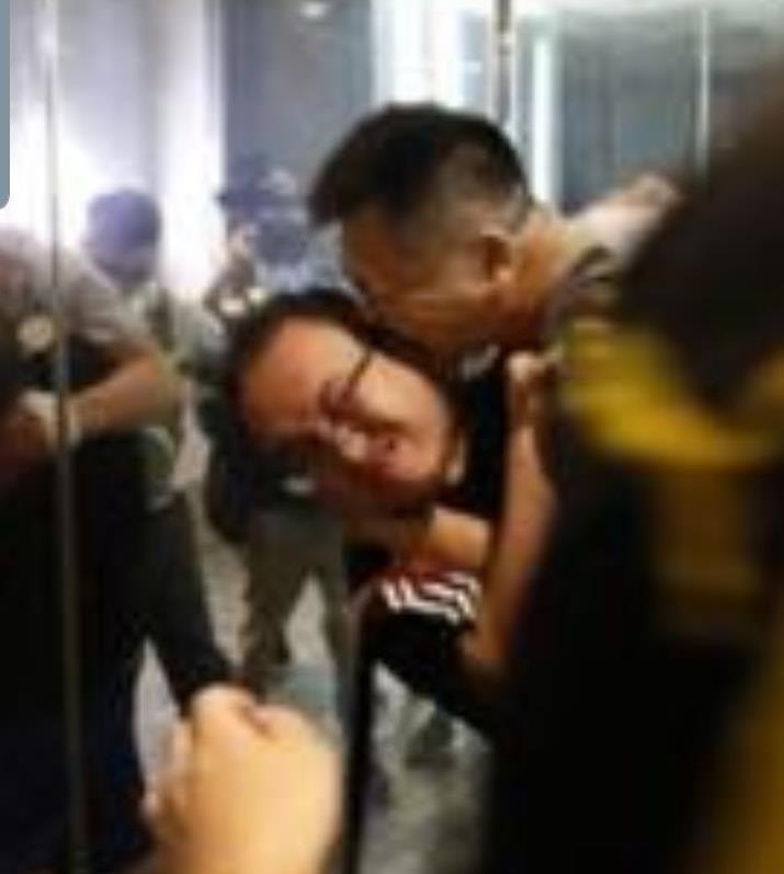 香港民主黨議員趙家賢欲制止凶嫌時,左耳遭咬傷,部分掉落。(翻攝自林卓廷臉書)