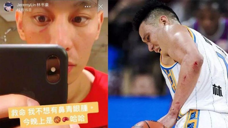 林書豪日前對上大鯊魚隊遭對手各式各樣的小動作，導致身上有不少傷口。（翻攝自微博）