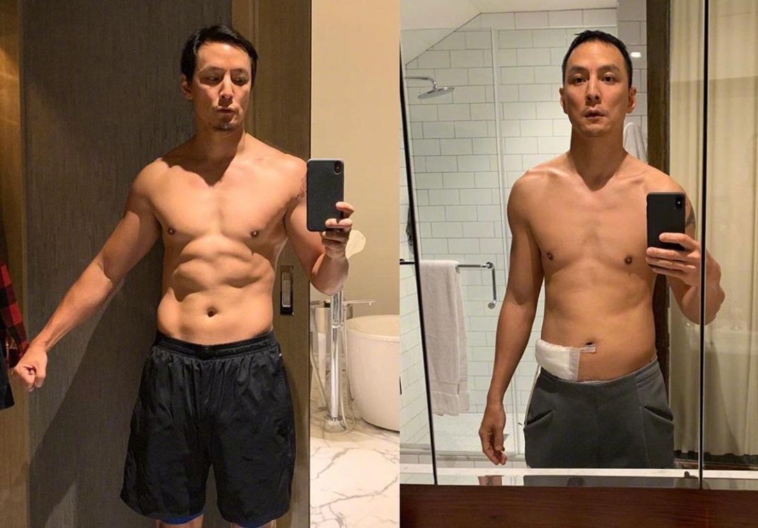 吳彥祖在微博分享大病初癒及近日身材對照圖,當時剛動完闌尾手術的他肌肉消風,整個人瘦了一圈。(翻攝自吳彥祖微博)