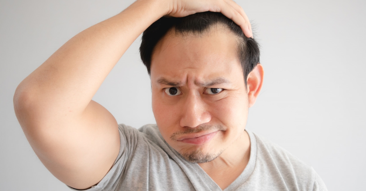 治療雄性禿，應找專業醫師諮詢。