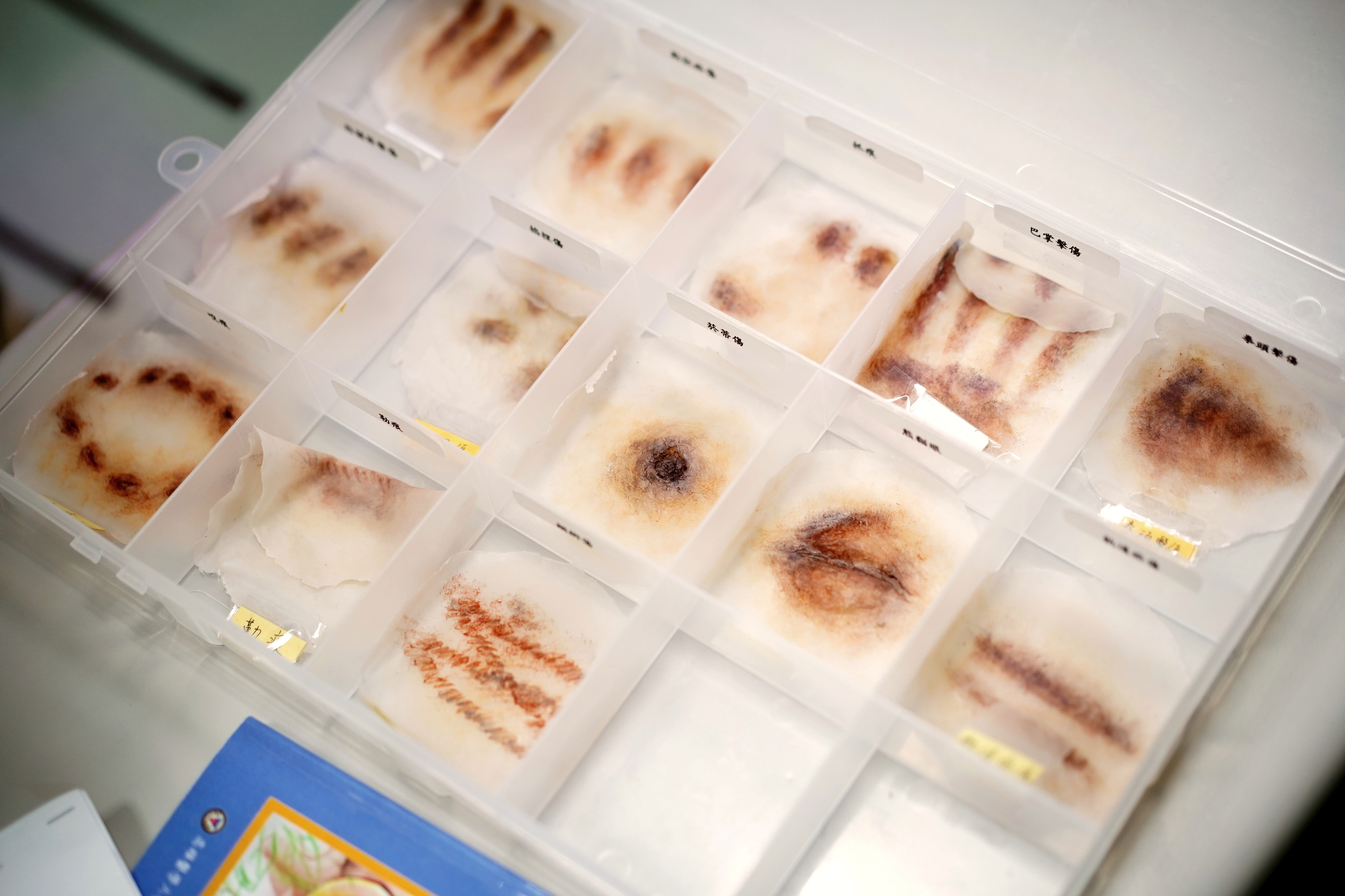 為了自製逼真的傷痕模型,尹莘玲試過黏土、石膏、矽膠等材質,還跑去台北找特效化妝師學習化特效妝。