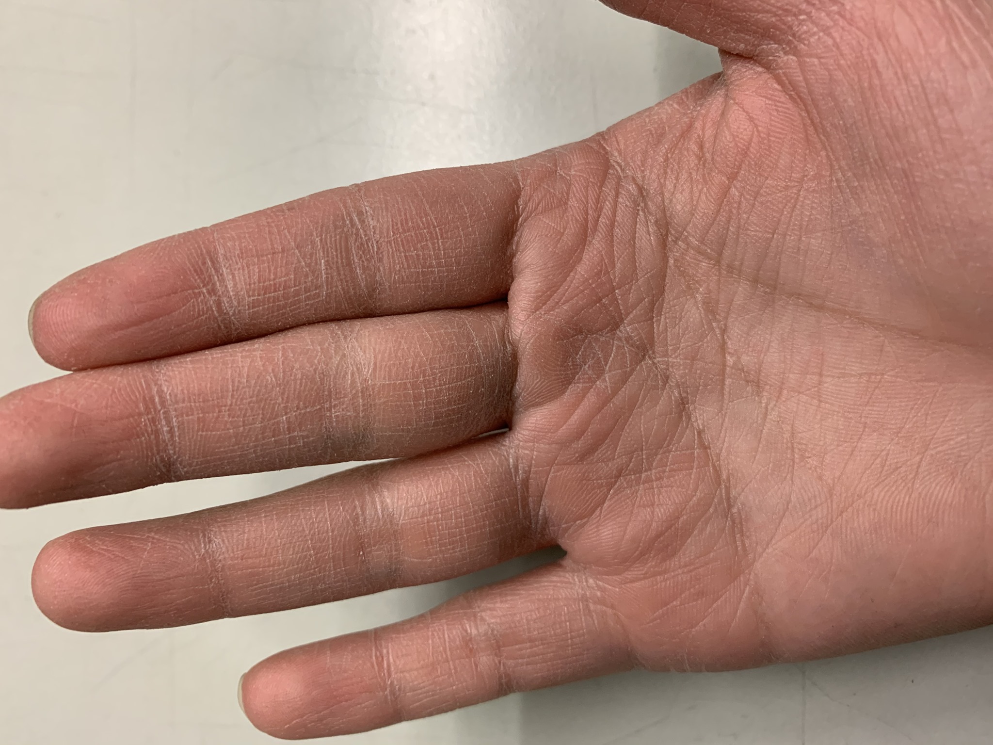 許多超商店員因長期用酒精消毒手部,已出現龜裂痕跡。(翻攝自靠北7-11)