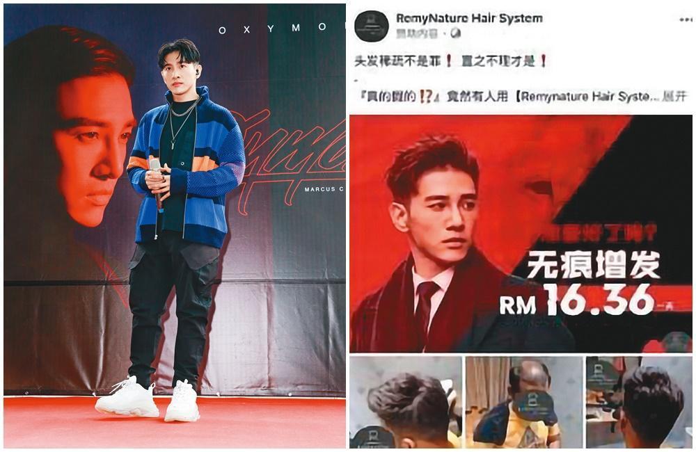 張立昂的照片遭不肖廠商盜用，成了生髮品的濃密髮對照組。（右圖翻攝自張立昂IG）